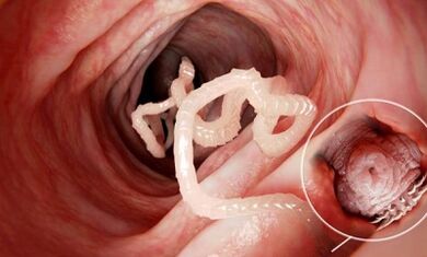 Como recoñecer a presenza de parasitos no intestino humano